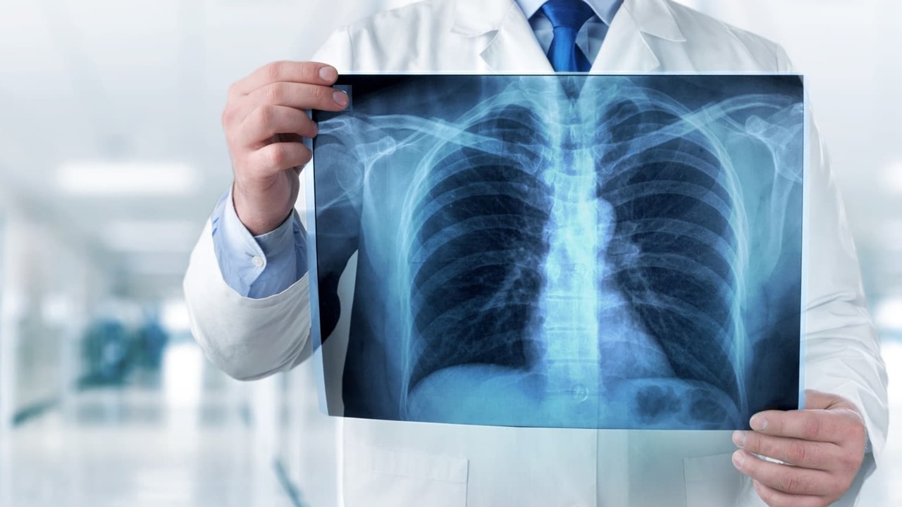 covid-19-pcr-yerine-x-ray.jpg